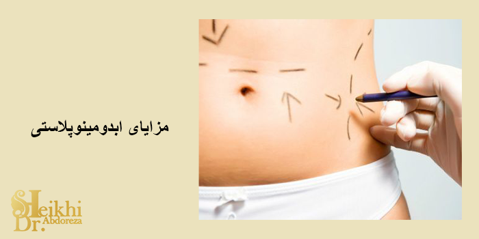 ابدومینوپلاستی 