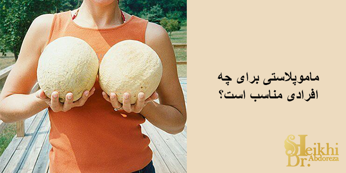 ماموپلاستی 