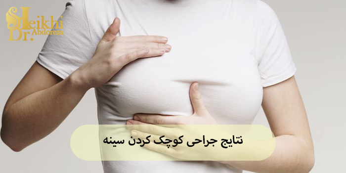 نتایج جراحی کوچک کردن سینه