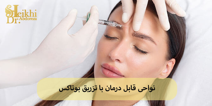 نواحی قابل درمان با تزریق بوتاکس