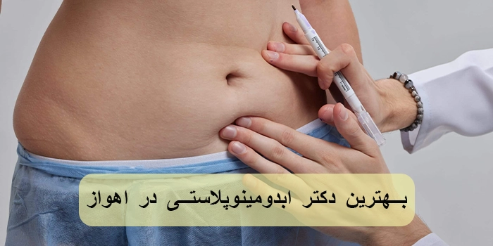 بهترین دکتر ابدومینوپلاستی در اهواز چه کسی است؟