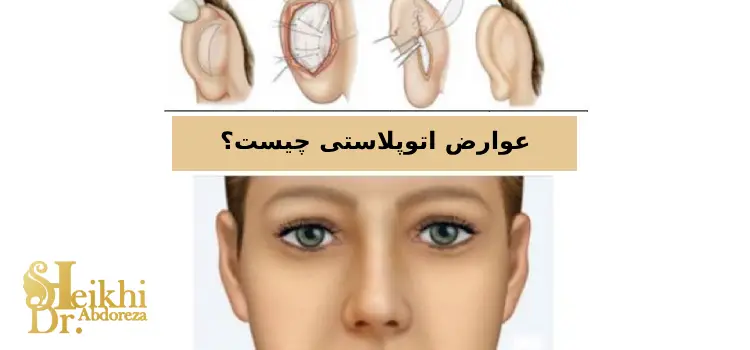 عوارض بعد از اتوپلاستی