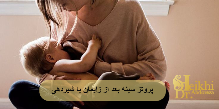 پروتز سینه بعد از زایمان یا شیردهی