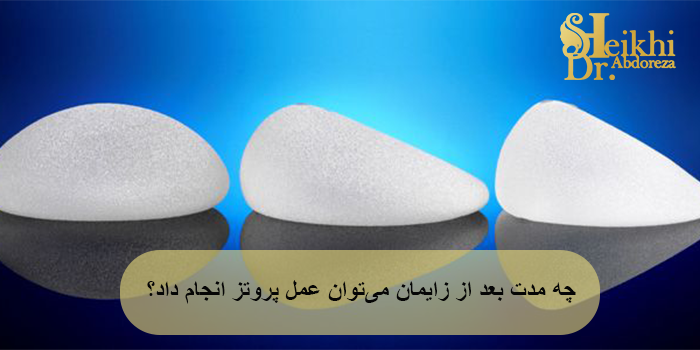 چه مدت بعد از زایمان میتوان عمل پروتز انجام داد؟