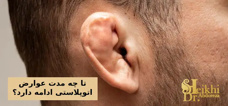 تا چه مدت عوارض اتوپلاستی ادامه دارد؟