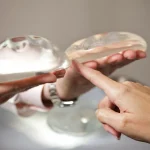 هزینه پروتز سینه