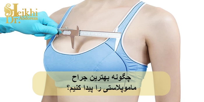 چگونه بهترین جراح ماموپلاستی را پیدا کنیم؟