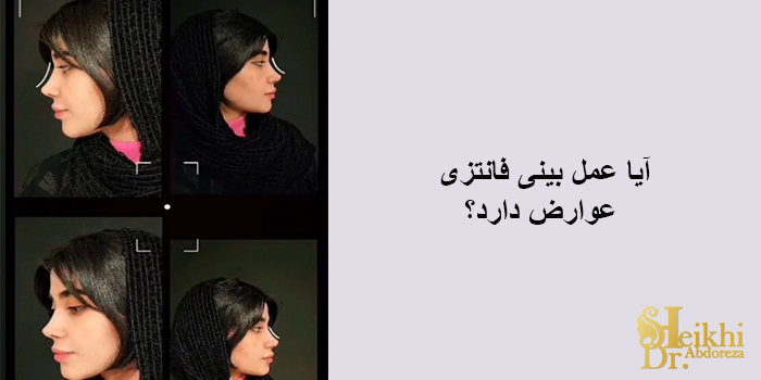 آیا عمل بینی فانتزی عوارض دارد؟