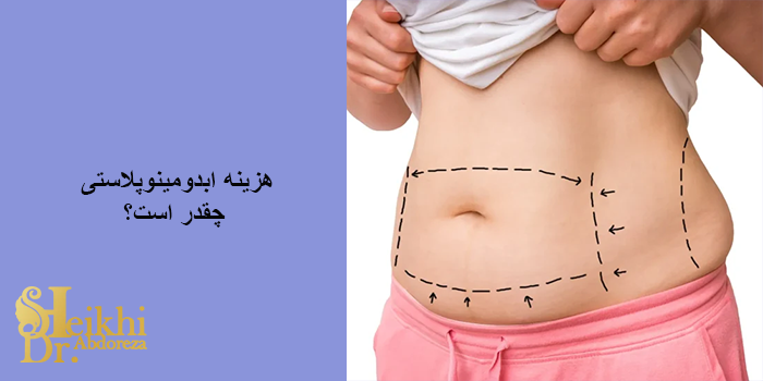 هزینه ابدومینوپلاستی