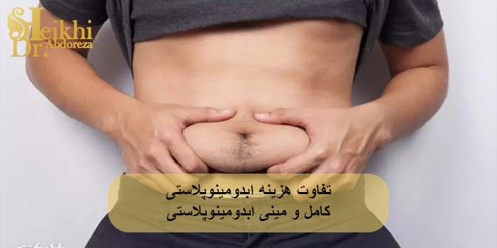 تفاوت هزینه ابدومینوپلاستی کامل و مینی ابدومینوپلاستی