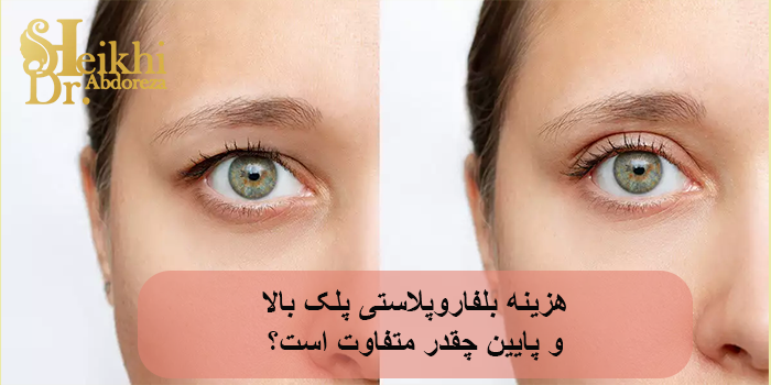 هزینه بلفاروپلاستی پلک بالا و پایین چقدر متفاوت است؟