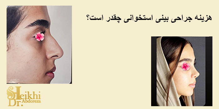 هزینه جراحی بینی استخوانی چقدر است؟