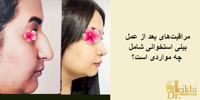 مراقبتهای بعد از عمل بینی استخوانی شامل چه مواردی است؟