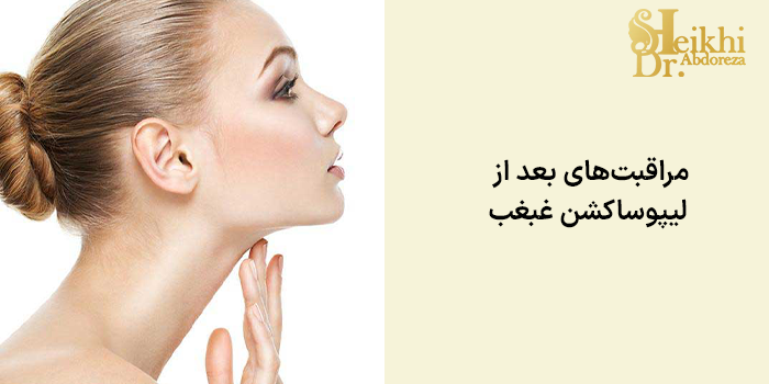 مراقبتهای بعد از لیپوساکشن غبغب