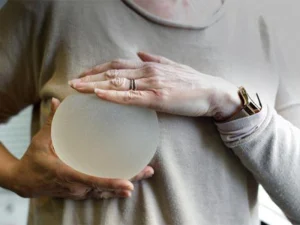 عوارض بعد از پروتز سینه