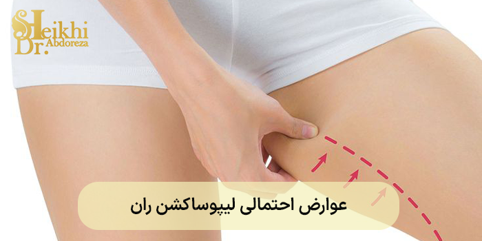 عوارض احتمالی لیپوساکشن ران