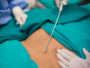 عوارض لیپوساکشن