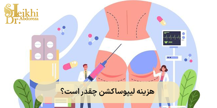 هزینه لیپوساکشن