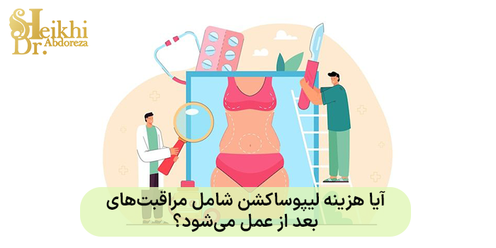 آیا هزینه لیپوساکشن شامل مراقبتهای بعد از عمل میشود؟