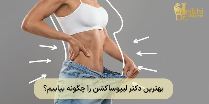 بهترین دکتر لیپوساکشن را چگونه بیابیم؟