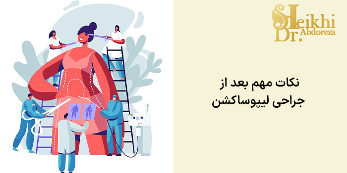 نکات مهم بعد از جراحی لیپوساکشن