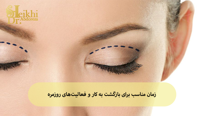 زمان مناسب برای بازگشت به کار و فعالیتهای روزمره