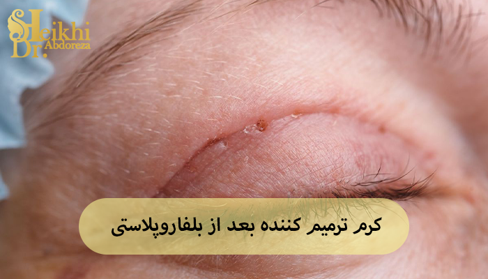 کرم ترمیم کننده بعد از بلفاروپلاستی