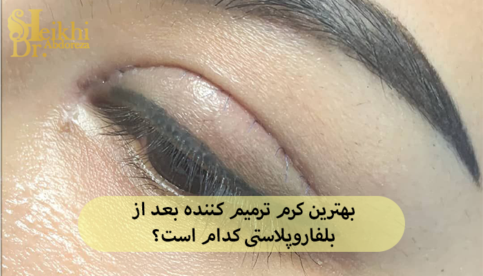 بهترین کرم ترمیم کننده بعد از بلفاروپلاستی کدام است؟