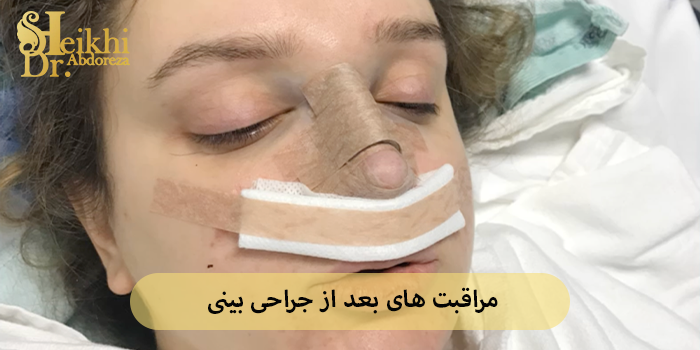 مراقبت های بعد از جراحی بینی چیست و چرا خیلی مهم است؟
