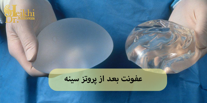 عفونت بعد از پروتز سینه
