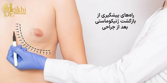 راههای پیشگیری از بازگشت ژنیکوماستی بعد از جراحی